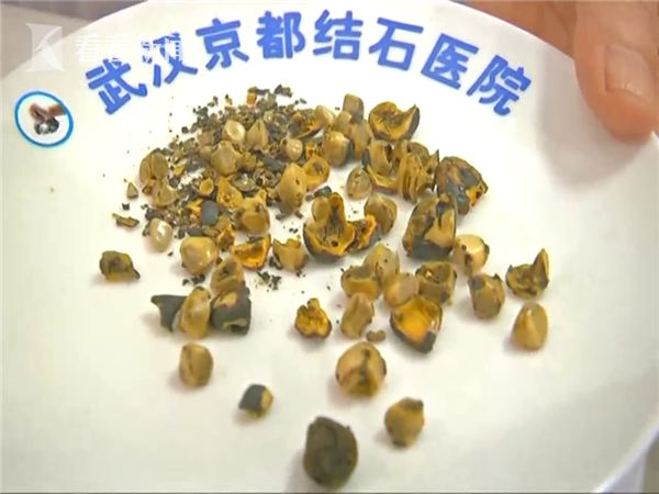 “jiuyou”中牟河务局明确下半年经济工作重点(图1) 九游娱乐官方网站